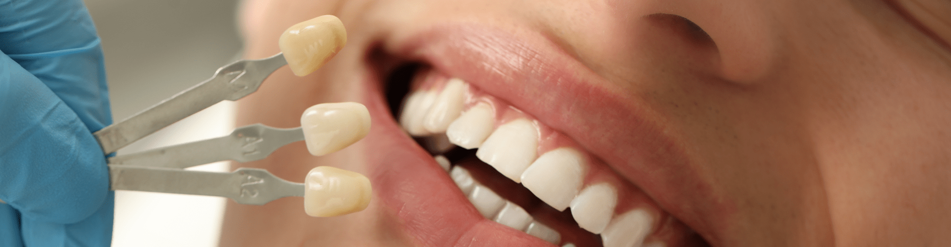 Gloved hands holding tooth shade-matching tool in front of smiling woman.